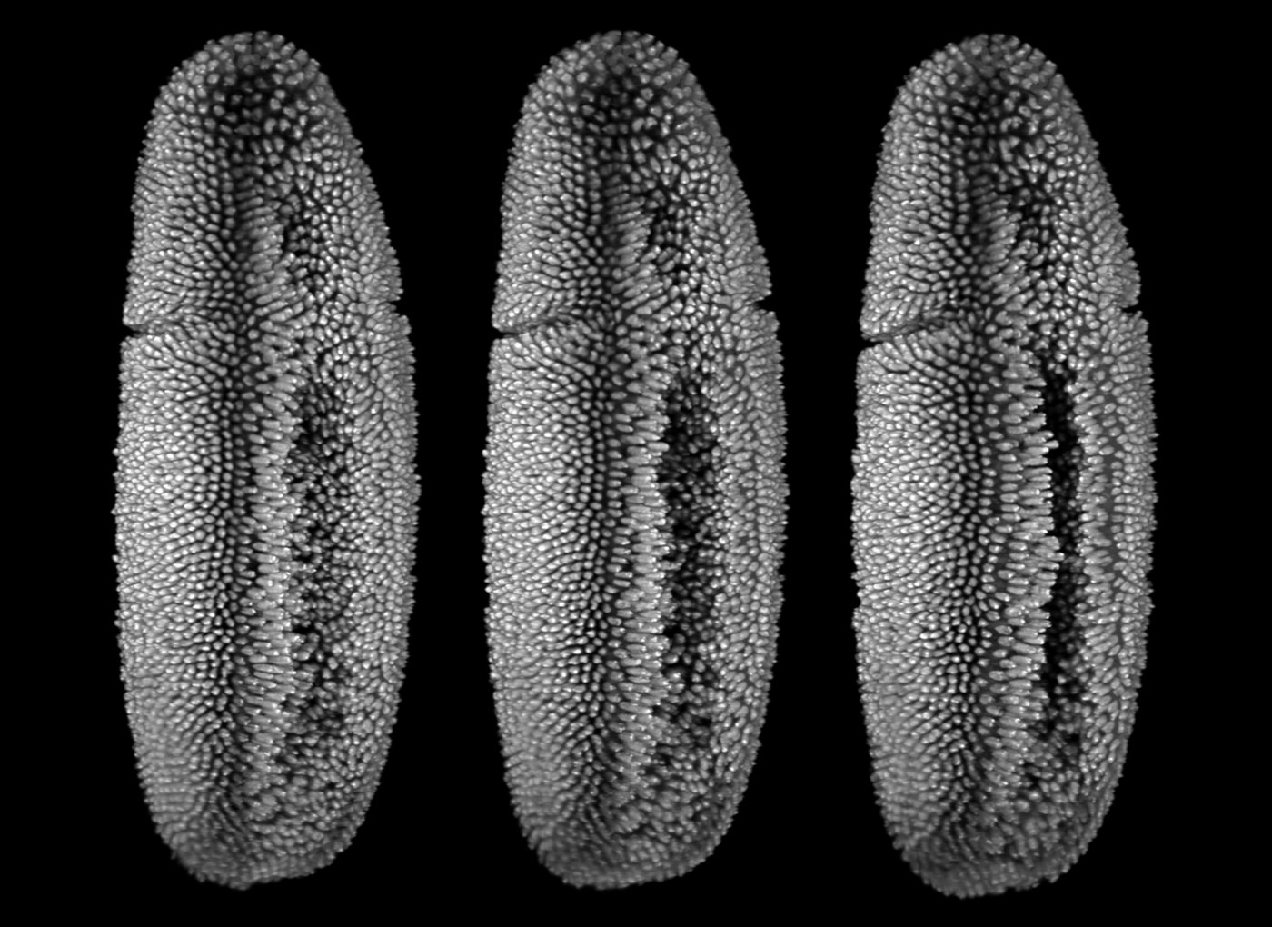 Fruit fly embryonic development