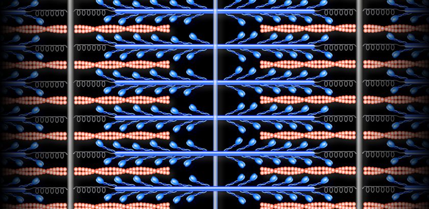 Sarcomere